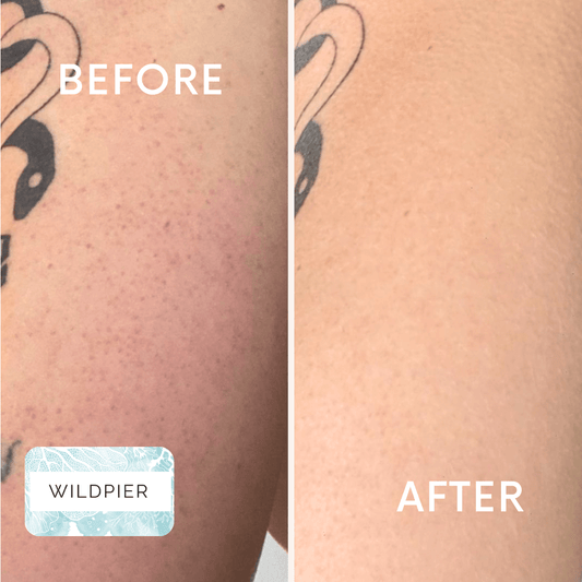 Wildpier™ Deep Exfoliating Glove and Konjac Sponges Bundle