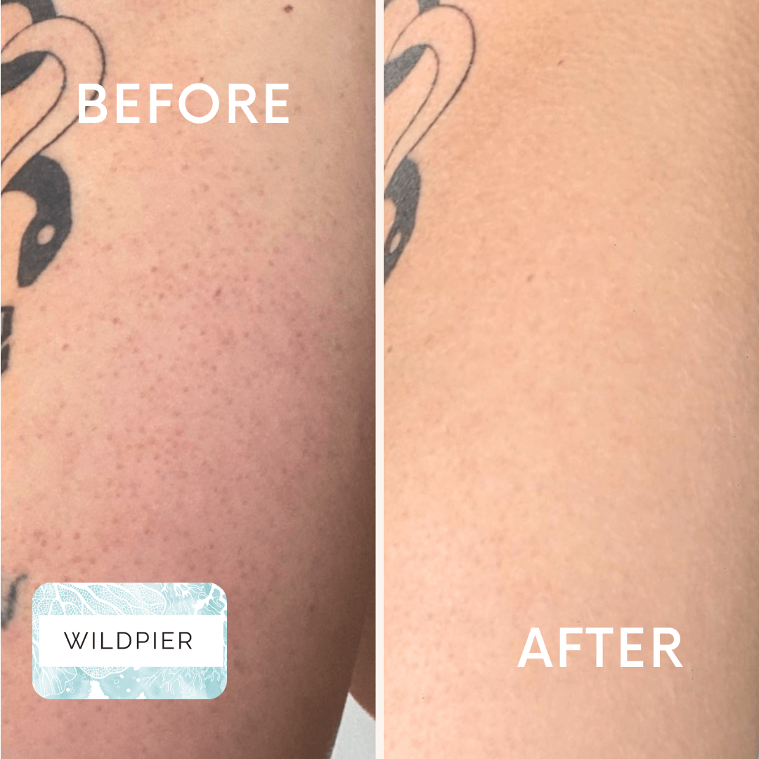 Wildpier™ Deep Exfoliating Glove and Konjac Sponges Bundle